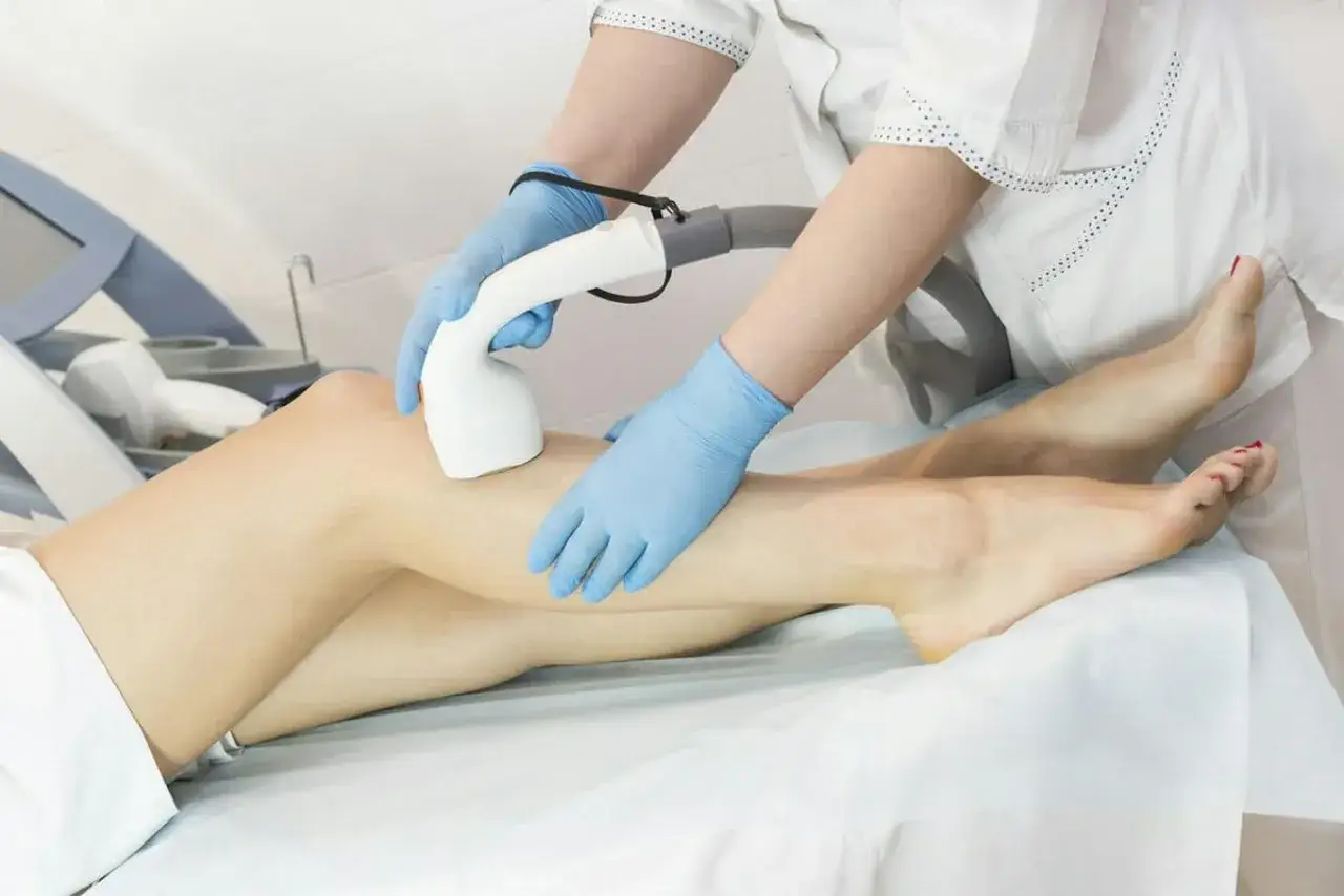 Zabieg depilacji laserowej nóg. Czy depilacja laserowa boli? Dłoń w rękawiczce trzyma głowicę lasera, przykładając ją do skóry.