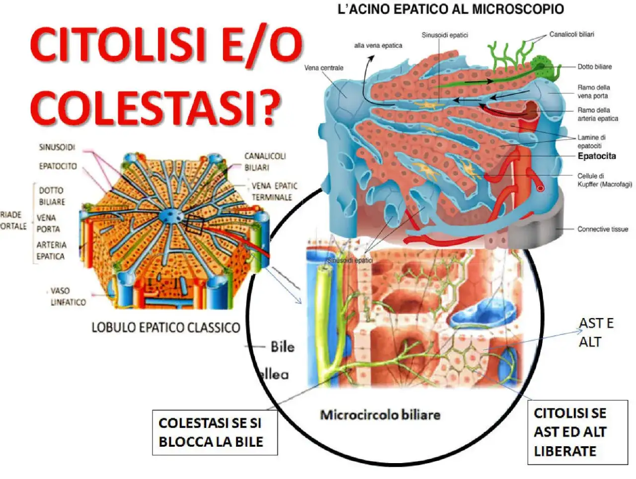 Diagrammi illustrano lobulo epatico e acino epatico, con focus su citolisi epatica e colestasi, evidenziando epatociti e vie biliari.