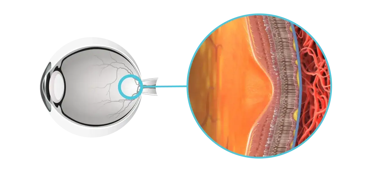 Sezione dell'occhio che mostra la macula, fondamentale per la visione nitida. Il suo significato &egrave; vitale per la percezione dei dettagli.