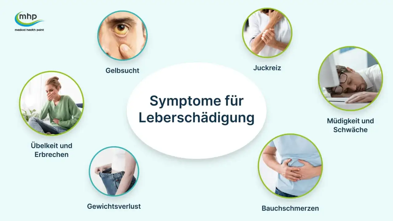 Gelbsucht, Juckreiz, Müdigkeit, Bauchschmerzen, Gewichtsverlust, Übelkeit: Symptome für Leberschädigung.
