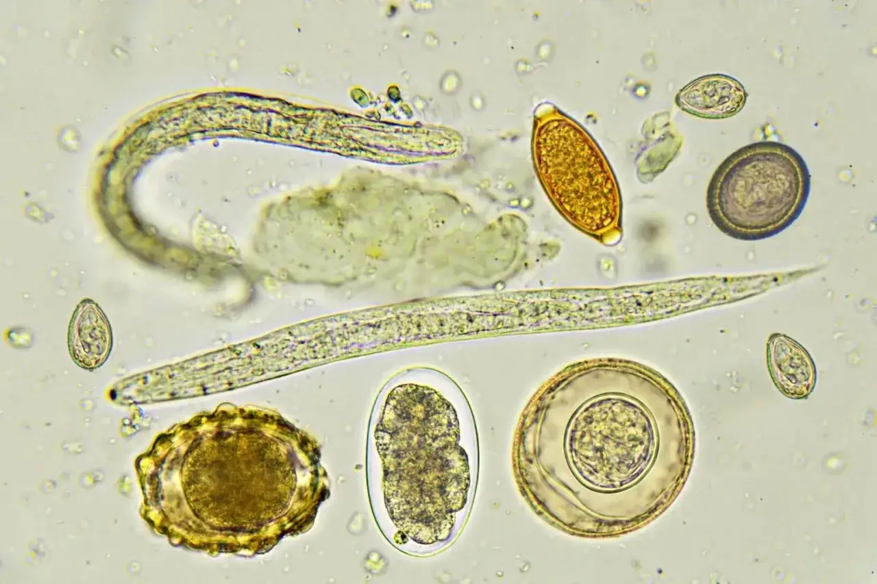 Vermi nei cani: immagine microscopica di uova e vermi intestinali, tra cui un nematode lungo e curvo e altri parassiti.
