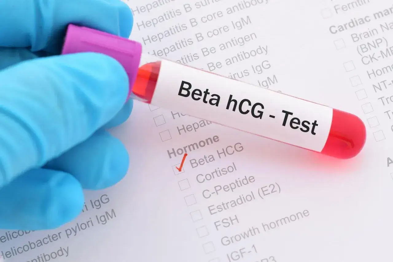 Guanto blu tiene provetta con campione per test Beta hCG. La lista di esami indica quando fare il test di gravidanza.