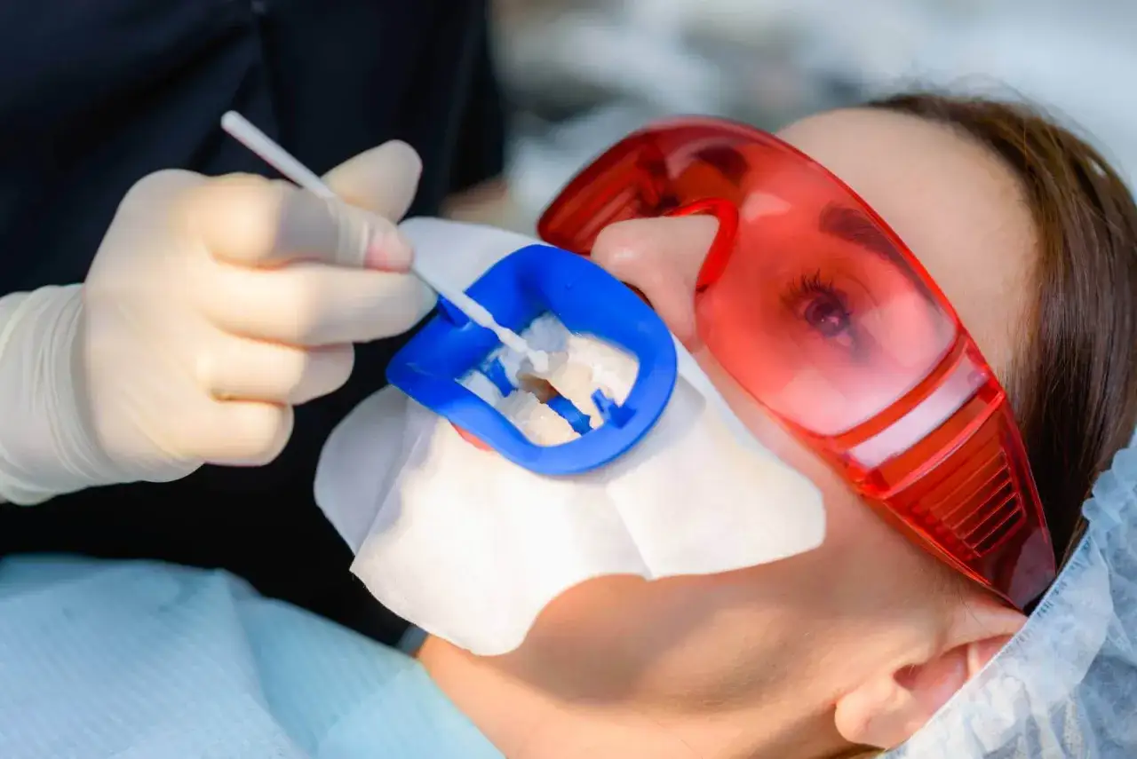 Dentysta aplikuje żel do fluoryzacji zęb&oacute;w. Pacjentka ma założone okulary ochronne.