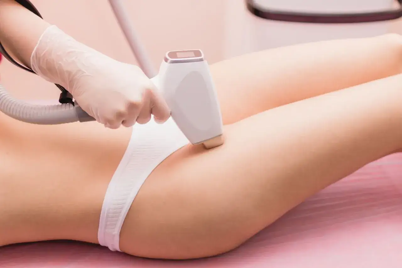 Zabieg laserowego usuwania owłosienia bikini. Dłoń w rękawiczce trzyma depilator, przykładając go do skóry.