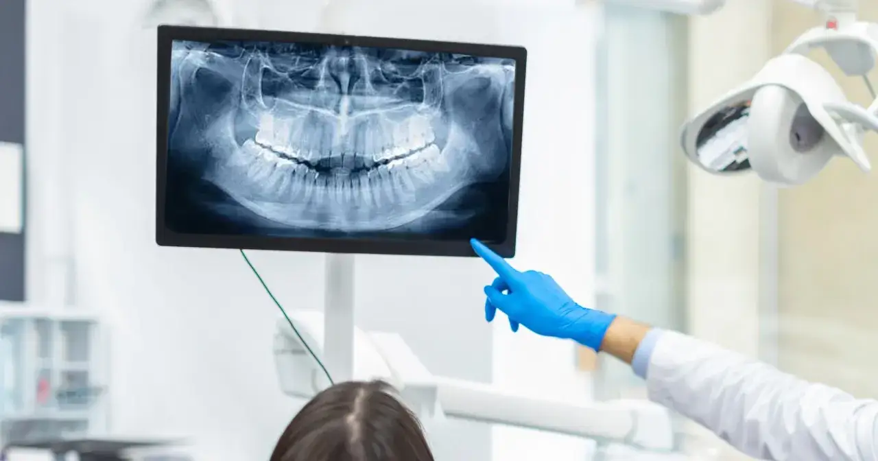 Dentysta w niebieskiej rękawiczce wskazuje na zdjęcie pantomograficzne zębów na monitorze. Zastanawiasz się, ile kosztuje zdjęcie zęba?