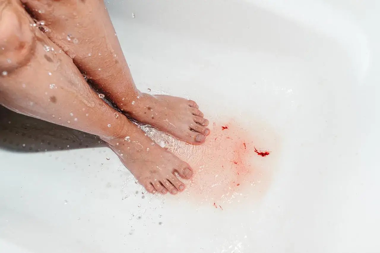 Piernas y pies en una ba&ntilde;era con agua te&ntilde;ida de rojo y co&aacute;gulos, sugiriendo menstruaci&oacute;n o complicaciones de embarazo.