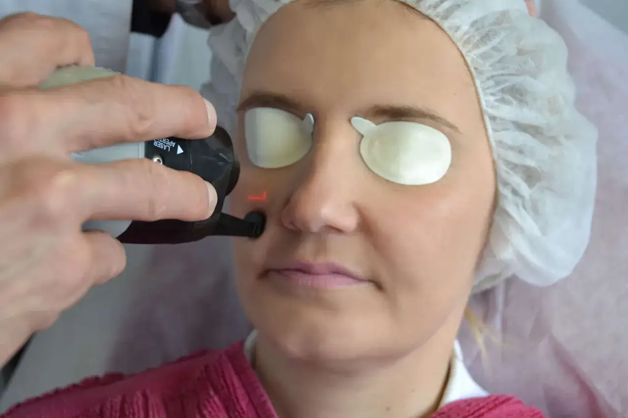 Behandlung von Lachfalten im Mundbereich mit einem Laser. Die Augen sind gesch&uuml;tzt.