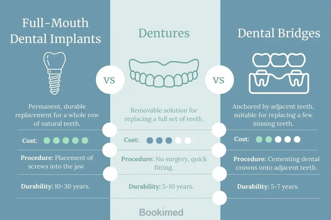Comparativa de implantes dentales, dentaduras y puentes. El coste de un implante dental completo es el más alto, pero ofrece durabilidad.