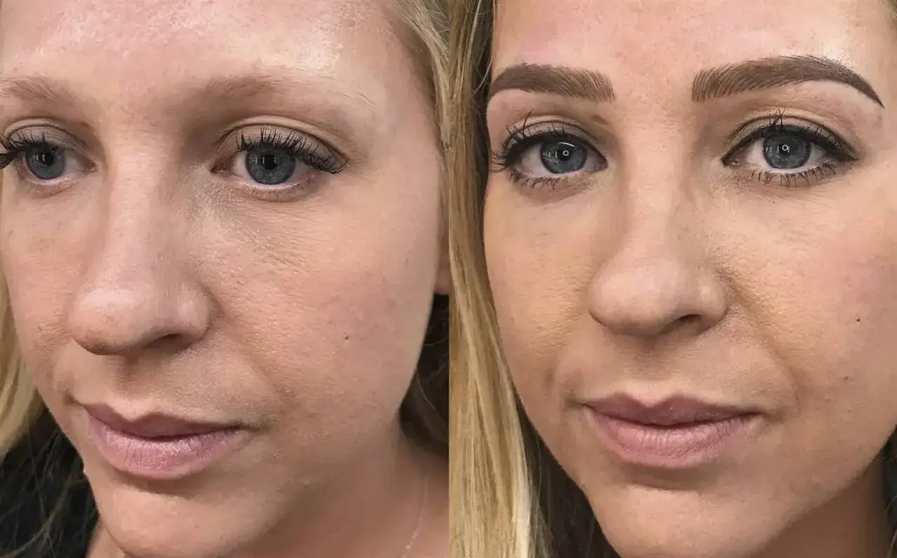 Comparativa de microblading cejas: antes y después. Cejas más definidas y pobladas, realzando la mirada.