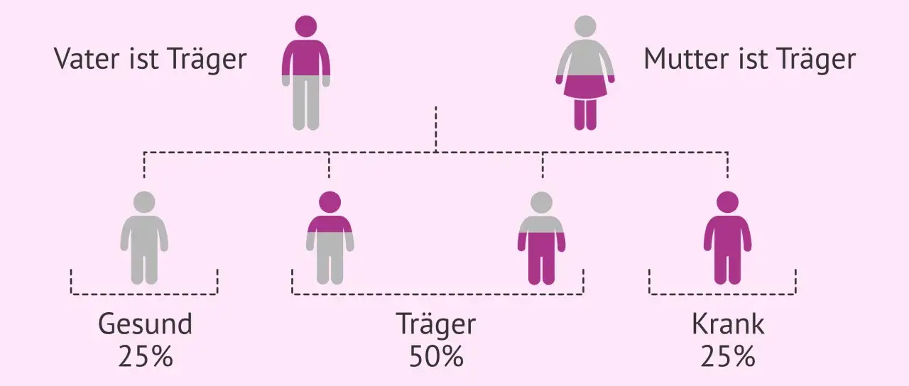 Stammbaum zeigt, wie demenz vererbbar sein kann. Vater und Mutter sind Tr&auml;ger, Kinder sind gesund (25%), Tr&auml;ger (50%) oder krank (25%).