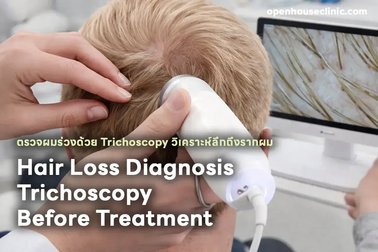 Dermatolog oceniający wypadanie włosów za pomocą trichoskopii. Badanie skóry głowy i włosów przed leczeniem.