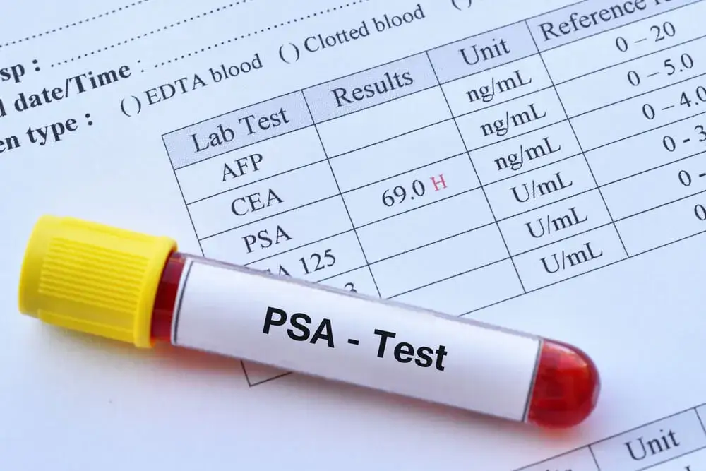 badanie PSA prostata