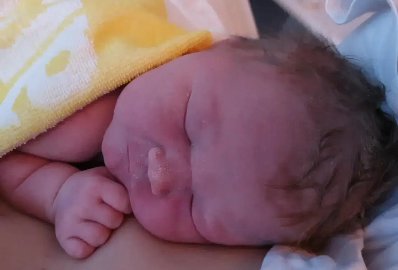 Nyf&ouml;dd bebis med m&ouml;rkbrunt h&aring;r, insvept i en gul och vit handduk. En liten segerhuva till en ny liten m&auml;nniska.