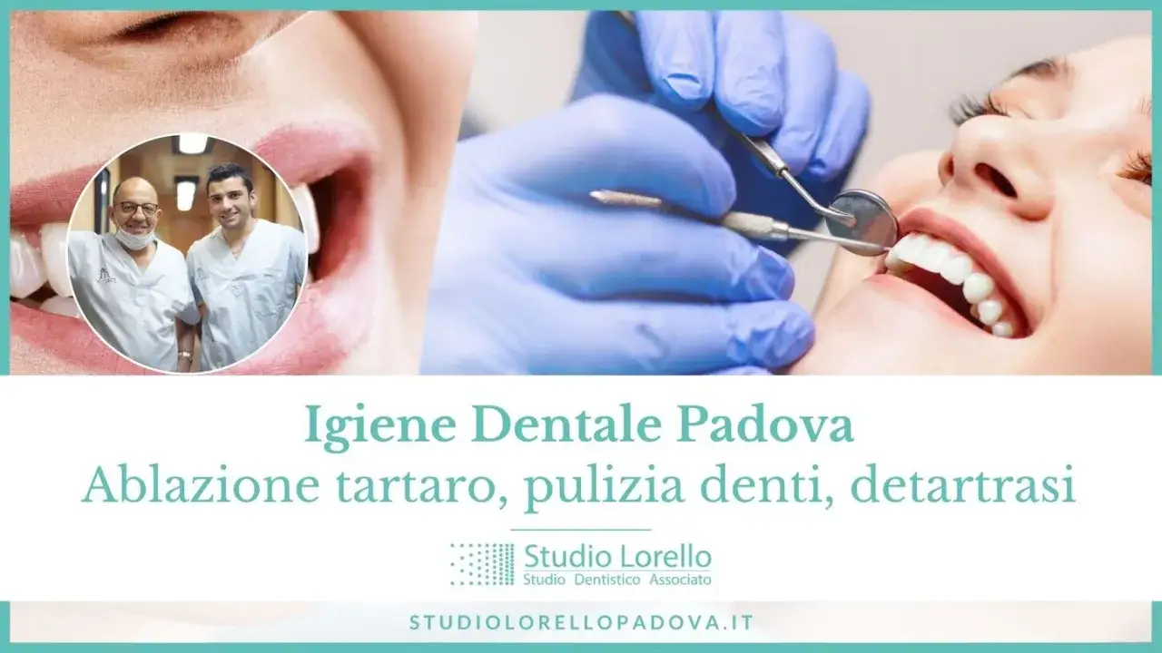 Studio dentistico a Padova offre igiene dentale, ablazione tartaro e pulizia denti. Un sorriso sano &egrave; il risultato di una corretta igiene orale.