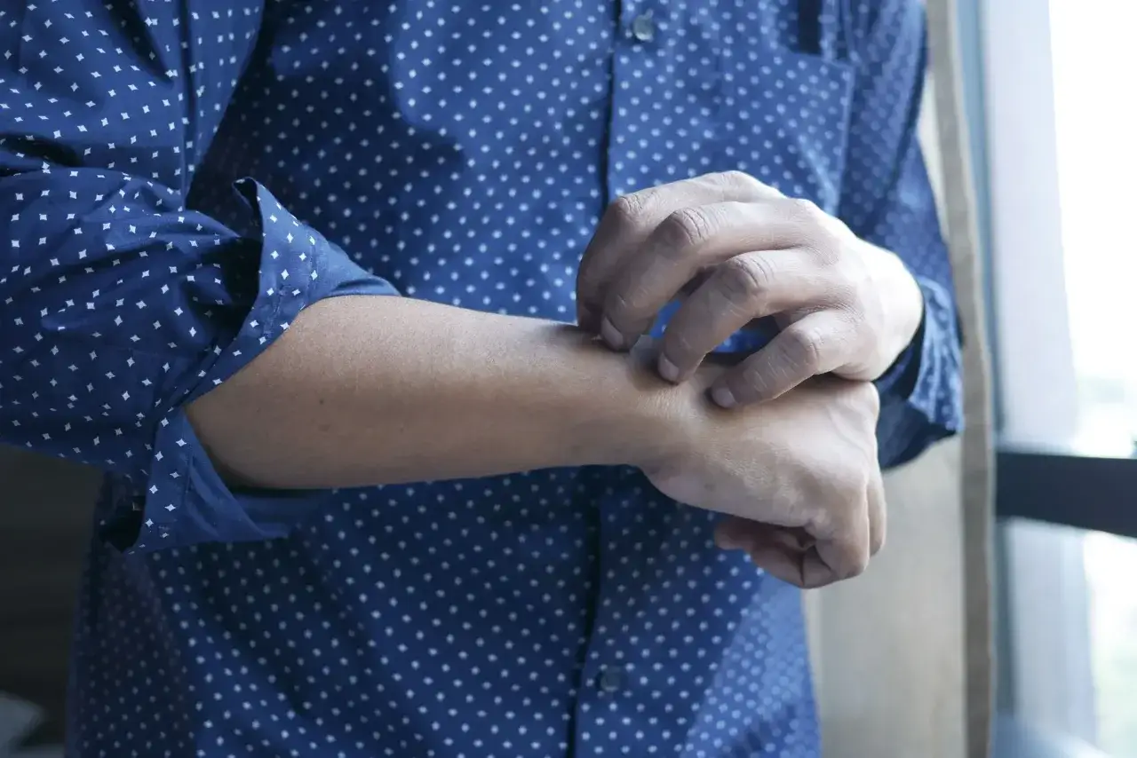Person med ADHD kliar sig på armen, ett tecken på dermatillomani.