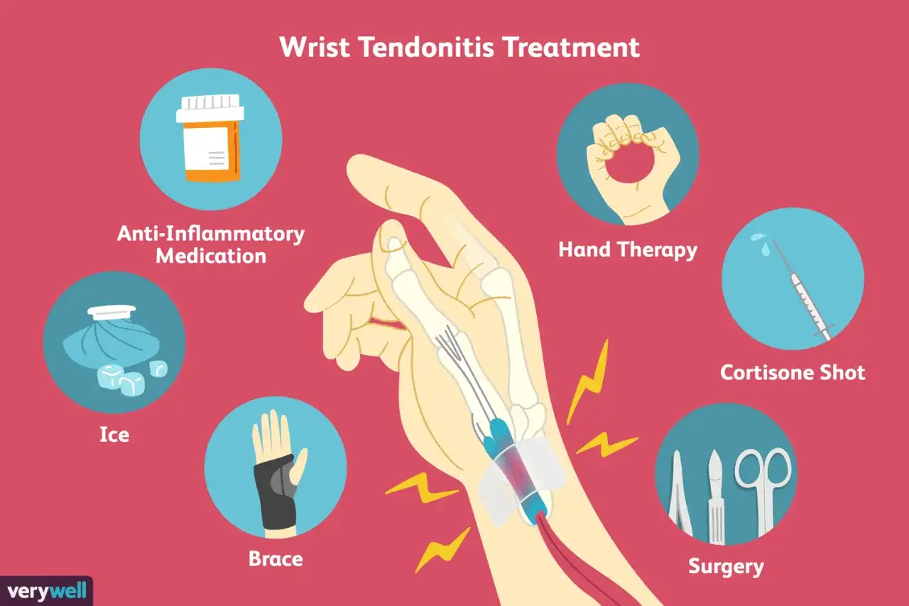 Tratamiento para tendinitis de mu&ntilde;eca: medicaci&oacute;n, hielo, f&eacute;rula, terapia manual, inyecci&oacute;n de cortisona y cirug&iacute;a. Los ejercicios son clave.