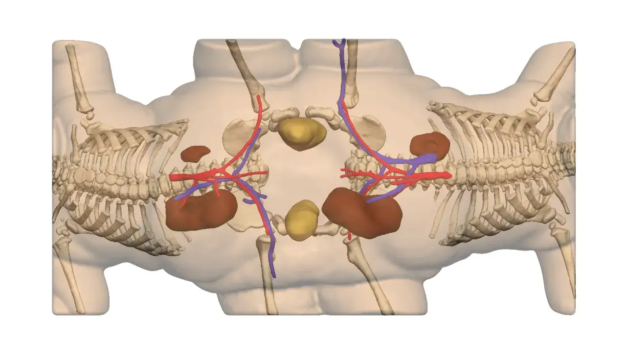Anatomische Darstellung von siamesischen Zwillingen mit gemeinsamen Organen und Skelettstrukturen.