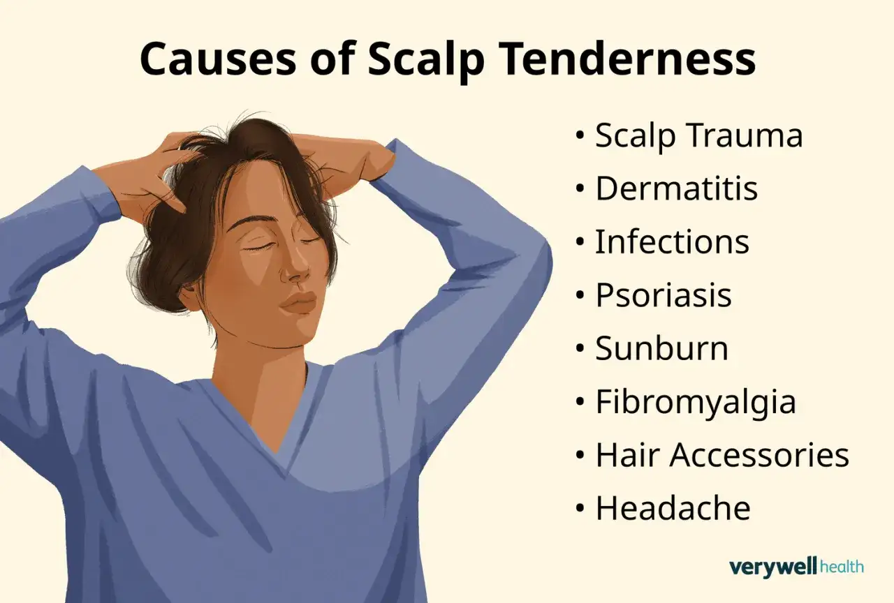Mujer con las manos en la cabeza, sintiendo dolor cuero cabelludo. Lista de causas: trauma, dermatitis, infecciones, psoriasis, quemadura solar, fibromialgia, accesorios para el cabello, dolor de cabeza.