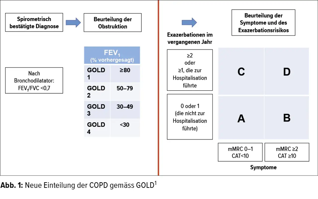 COPD GOLD 3 bedeutet eine FEV1 von 30-49% des Vorhergesagten. Dies ist Teil der Einteilung nach GOLD.