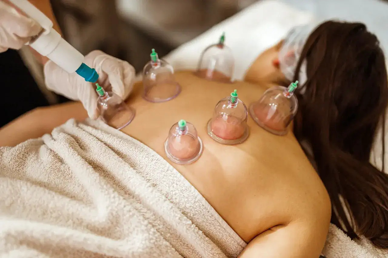 Masaż bańką chińską: terapeuta w rękawiczkach aplikuje bańki na plecy pacjentki. Zwróć uwagę na masaż bańką chińską przeciwwskazania.