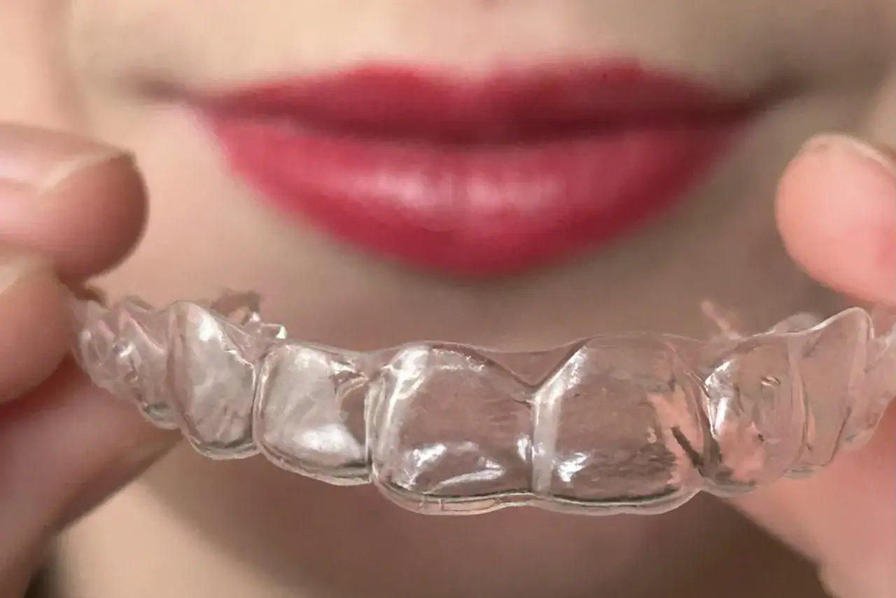 Przezroczysty aparat Invisalign, który koryguje uśmiech. Zastanawiasz się nad Invisalign aparat cena?