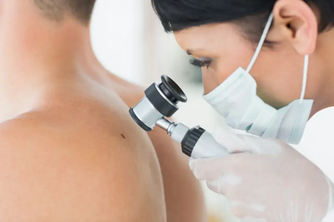 Lekarz w masce i rękawiczkach wykonuje badanie dermatoskopowe pieprzyka na ramieniu pacjenta.