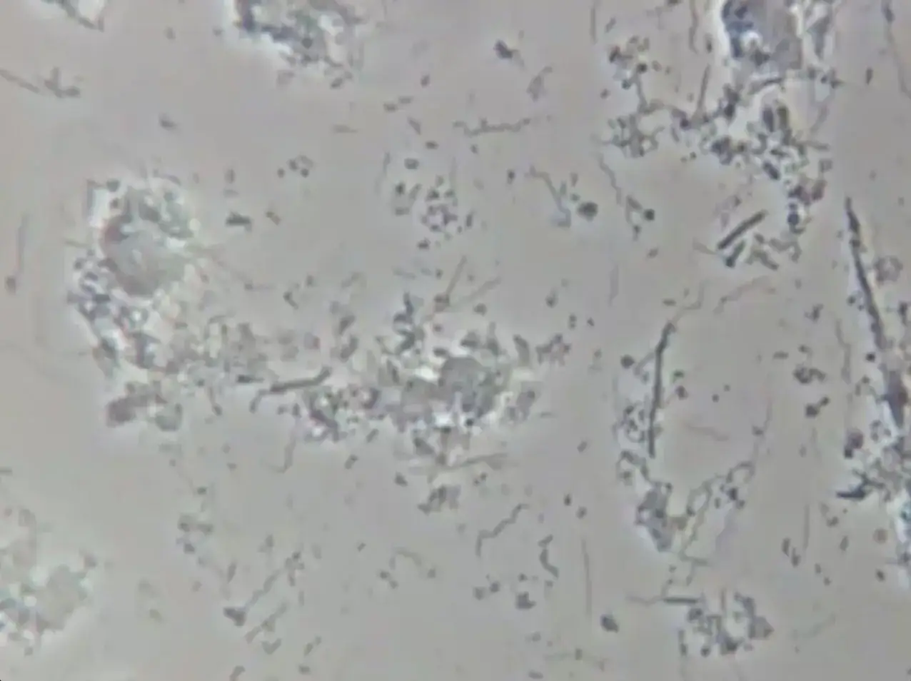 Mikroskopowy obraz pokazuje liczne bakterie na zębach, w tym spiralne formy, tworzące biofilm.