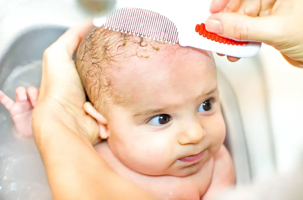 Mani delicate rimuovono la crosta lattea dal cuoio capelluto di un neonato con un pettinino.