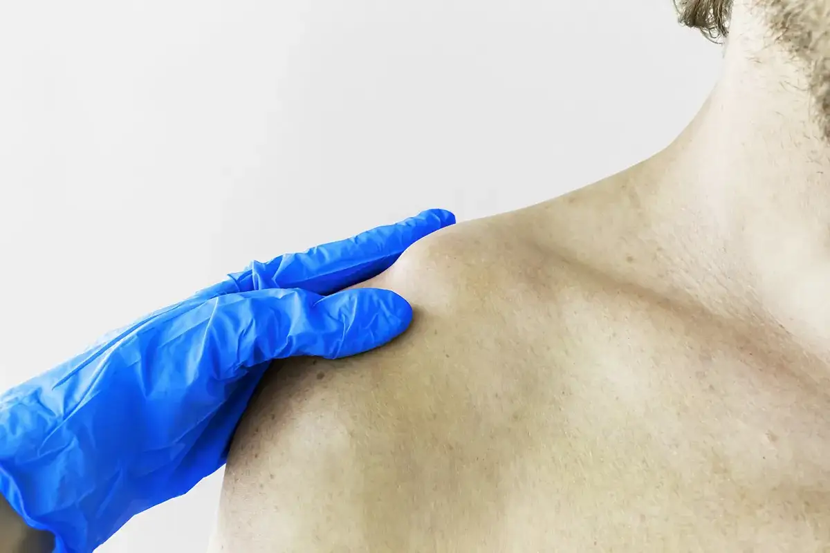 Blauer Handschuh tastet das SCG Gelenk ab, um eine mögliche Verletzung zu diagnostizieren.