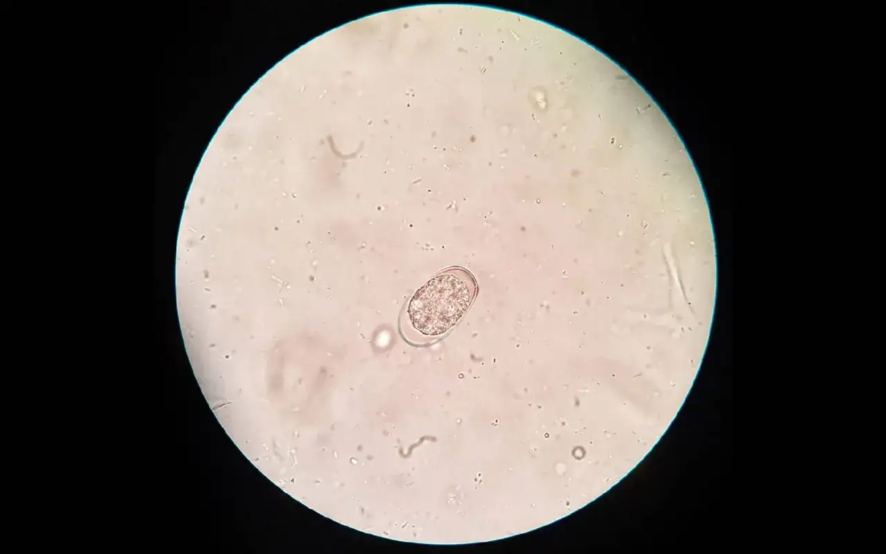 Mikroskopische Aufnahme eines Kokzidien-Eies, wichtig f&uuml;r die Diagnose und um Kokzidien zu behandeln.