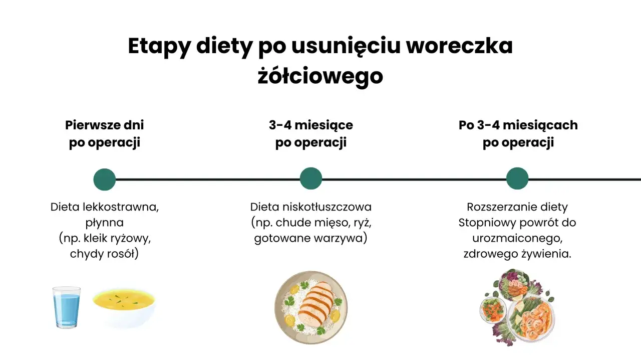 Etapy diety po usunięciu woreczka ż&oacute;łciowego: lekkostrawna, niskotłuszczowa, a potem powr&oacute;t do zdrowego żywienia.