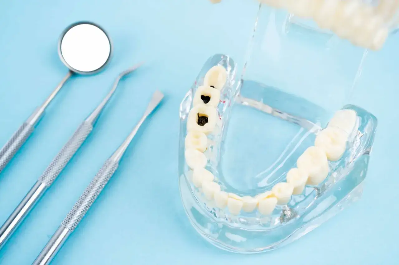 Model szczęki z próchnicą i narzędzia dentystyczne. Planujesz leczenie zębów w Turcji?