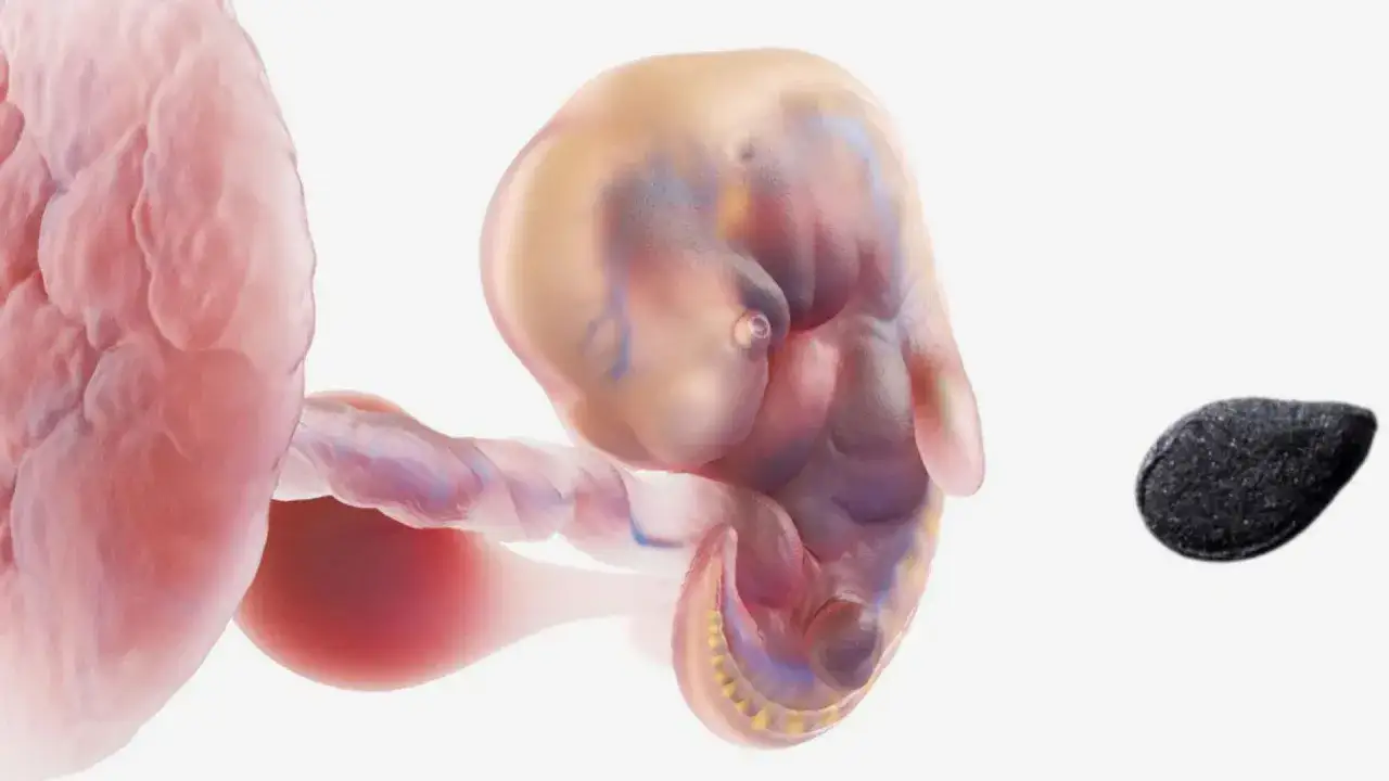 Embrione di 5 settimana di gravidanza, delle dimensioni di un seme di sesamo, attaccato all'utero.