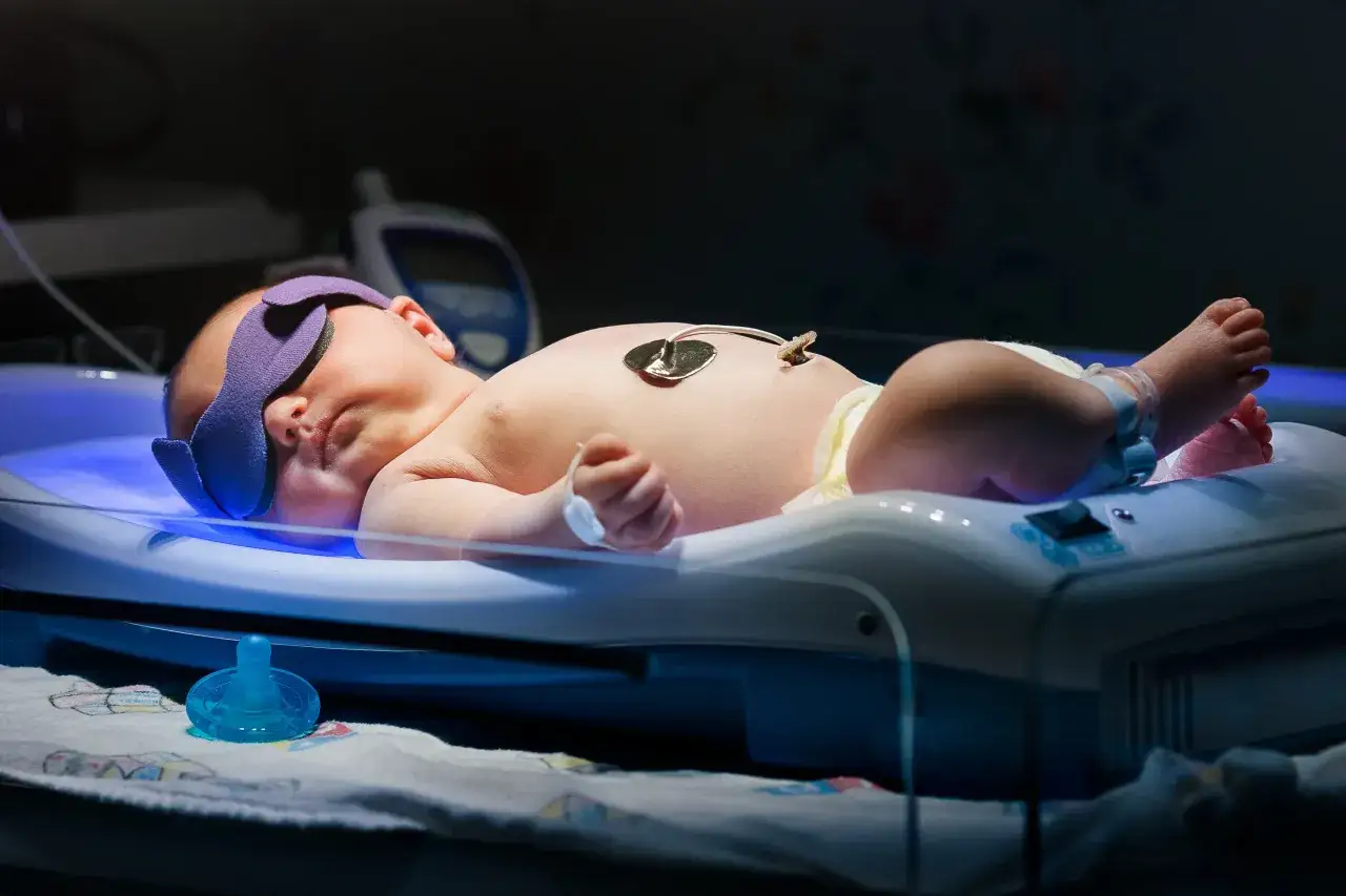 Nowe życie pod lampami. Czy dziecko urodzone w 37 tygodniu jest wcześniakiem? Maluch w inkubatorze, z opaską na oczach, podłączony do aparatury.