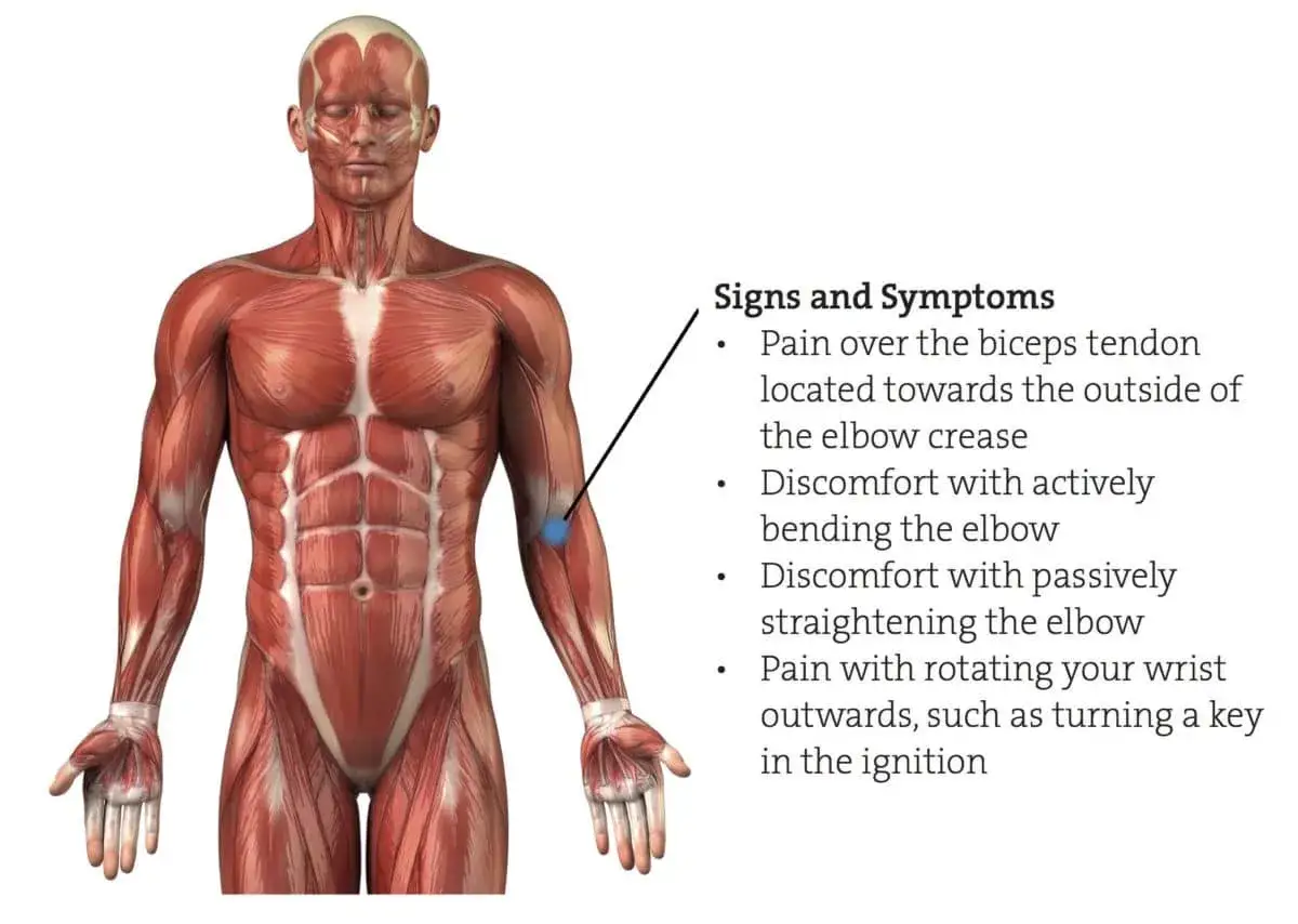 Anatomia człowieka z zaznaczonym mięśniem dwugłowym ramienia. Opis objawów bólu w okolicy łokcia.