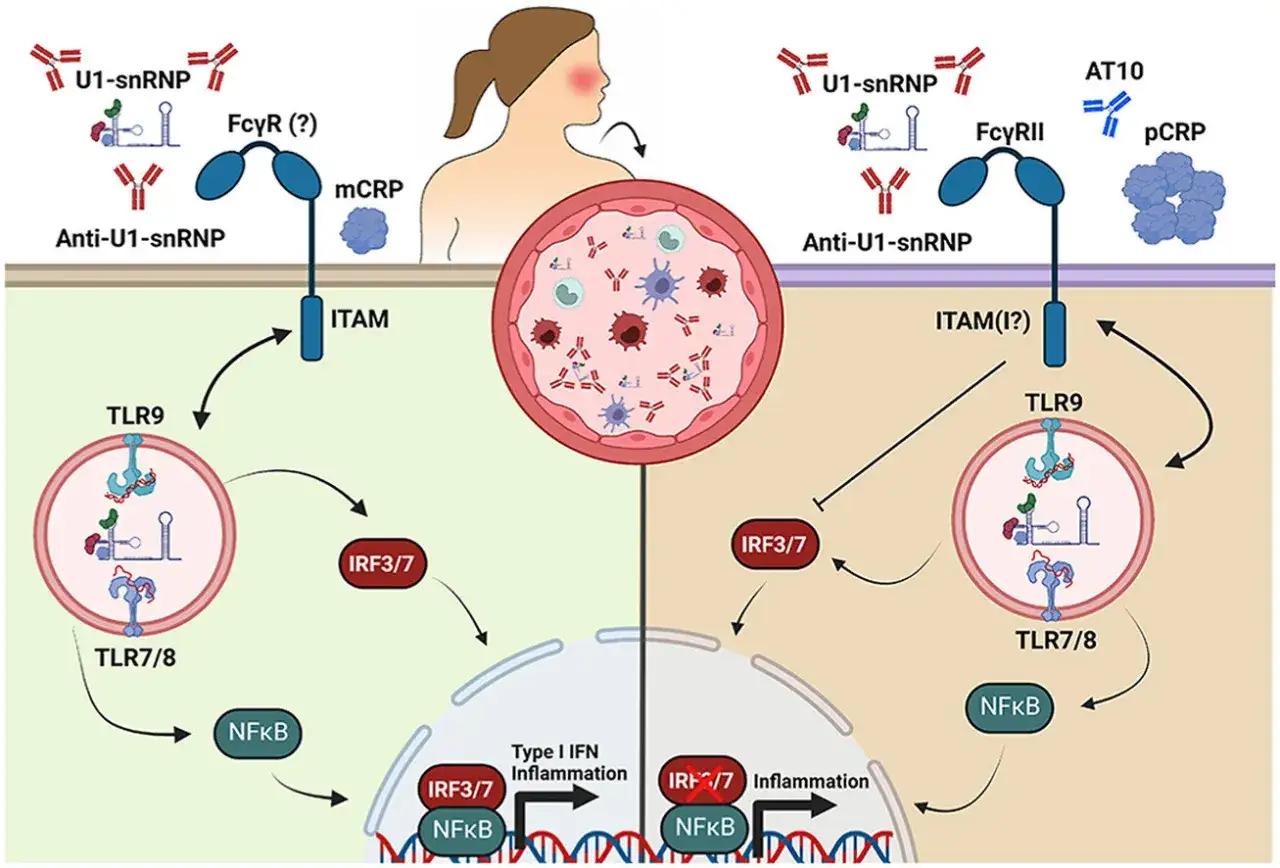Schema che illustra come anticorpi anti-U1-snRNP e pCRP attivano vie infiammatorie tramite TLR, portando a infiammazione di tipo I e IRF3/7.