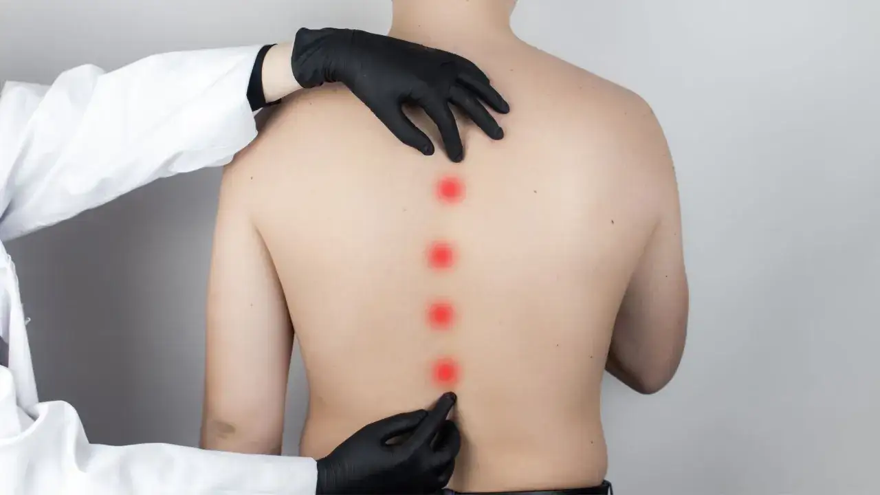 Lekarz bada plecy pacjenta, wskazując punkty bólu na kręgosłupie piersiowym, sugerujące objawy neurologiczne.