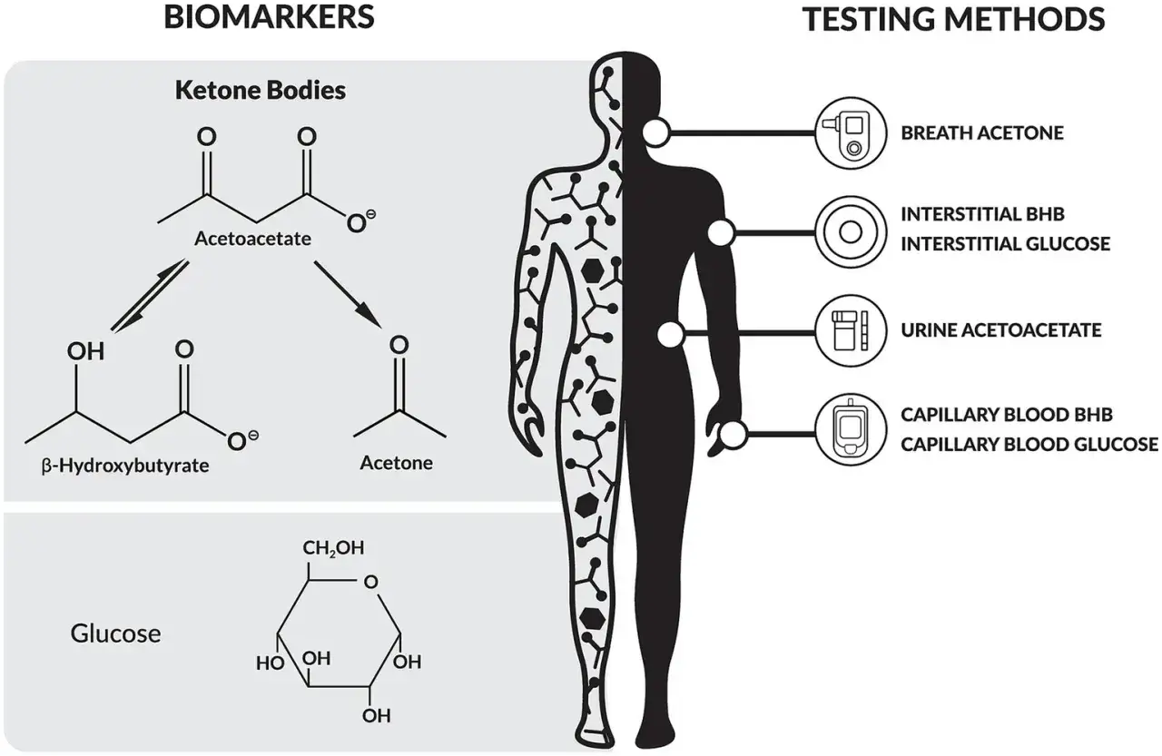 Schemat przedstawia markery ketozy: ciała ketonowe (acetoacetat, beta-hydroksymaślan, aceton) i glukozę, oraz metody ich badania: oddech, płyn tkankowy, mocz, krew.