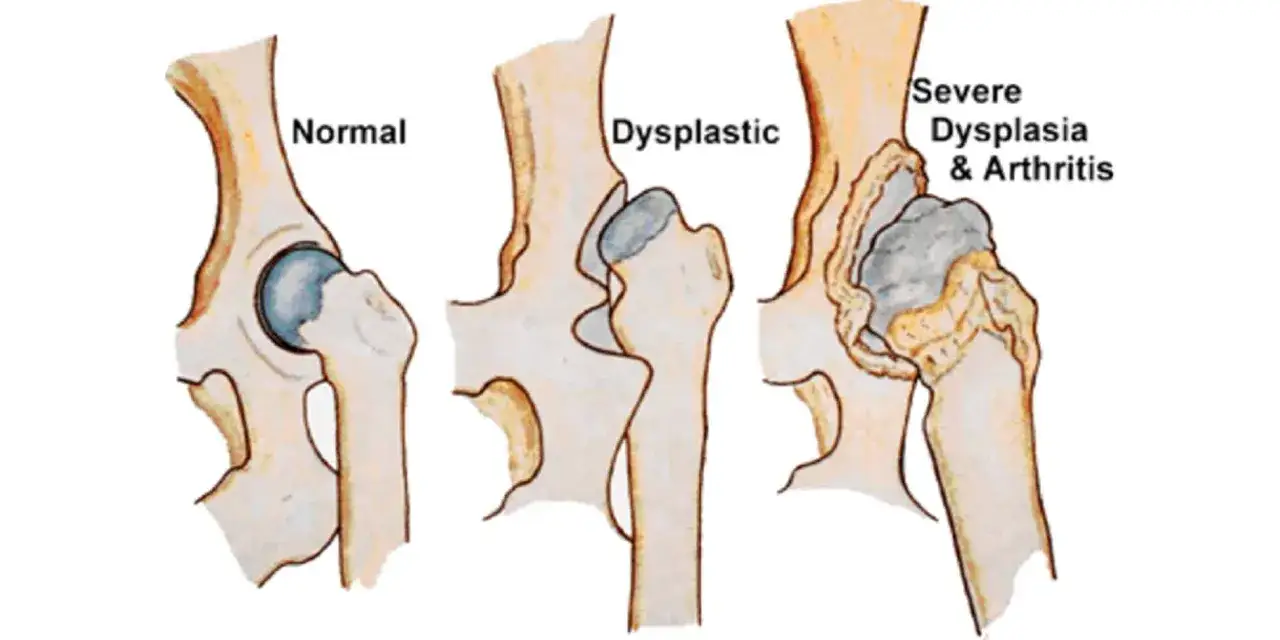 Illustrazione comparativa di anca di cane: normale, displastica e con grave displasia e artrite. La postura del cane è influenzata da queste condizioni.