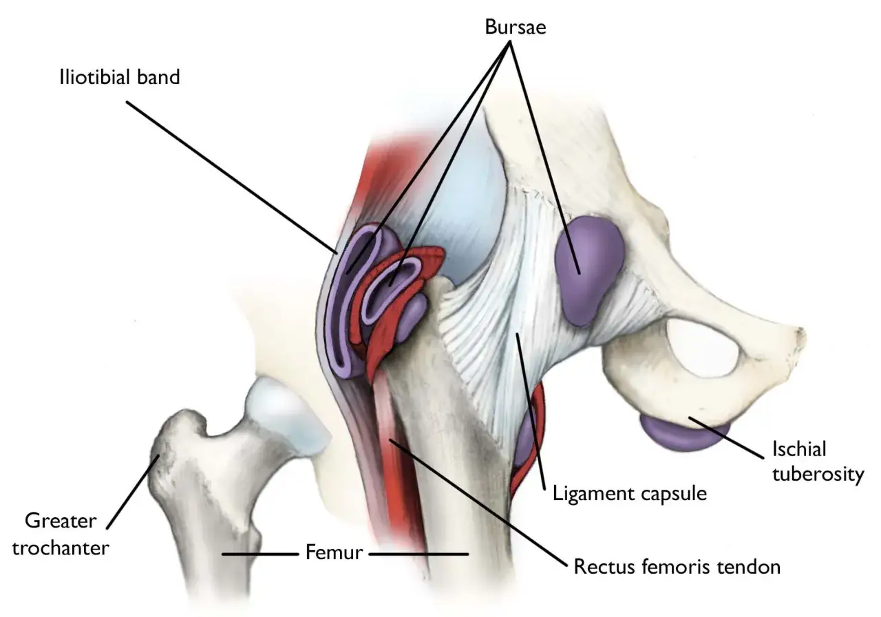 Ilustracja anatomiczna biodra z zaznaczonym pasmem biodrowo-piszczelowym, kaletkami i ścięgnem mięśnia prostego uda, wyjaśniająca zespół trzaskającego biodra.