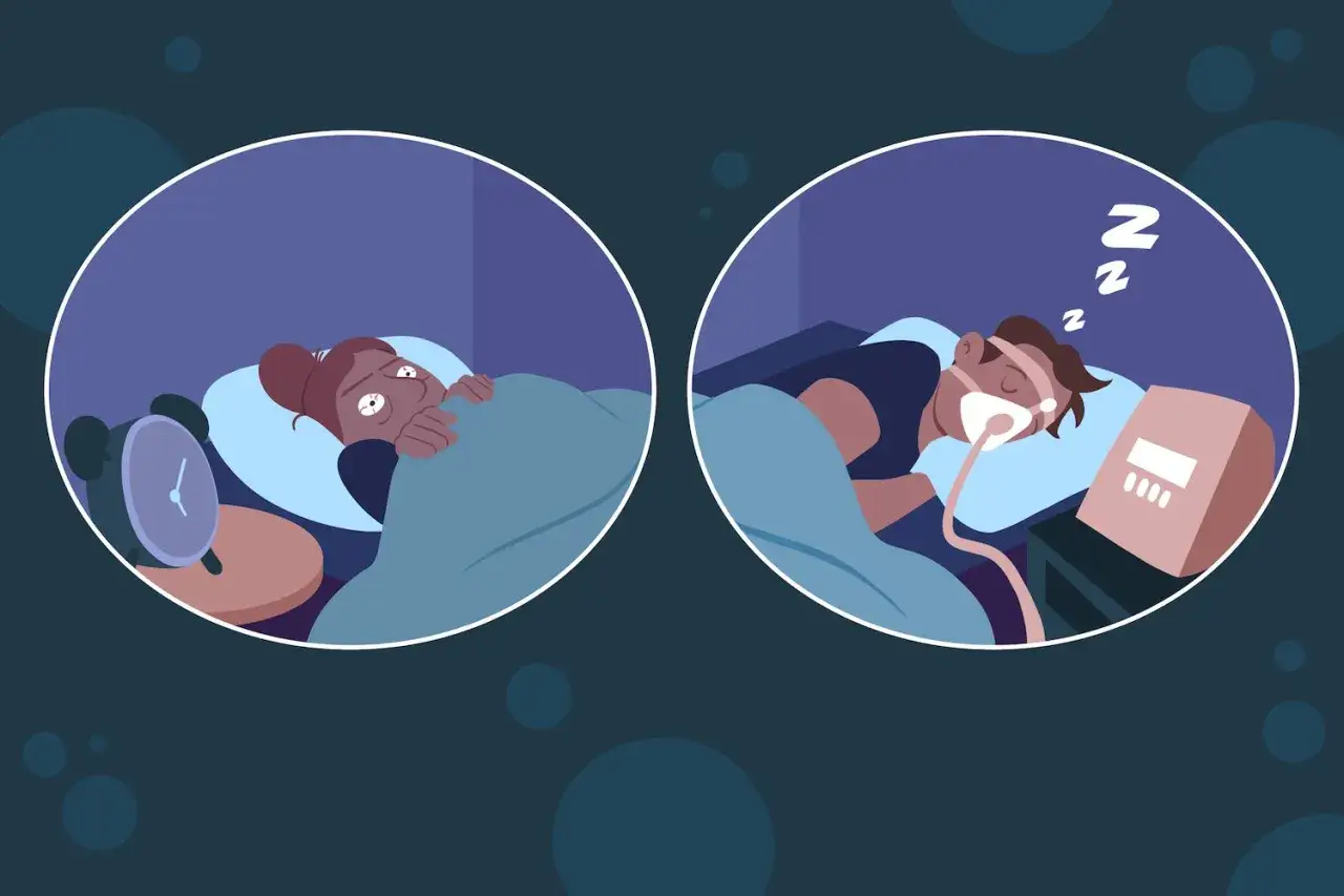 A person awake in bed with an alarm clock, contrasted with someone sleeping soundly with a CPAP machine, illustrating the difference between insomnia and short sleeper syndrome.