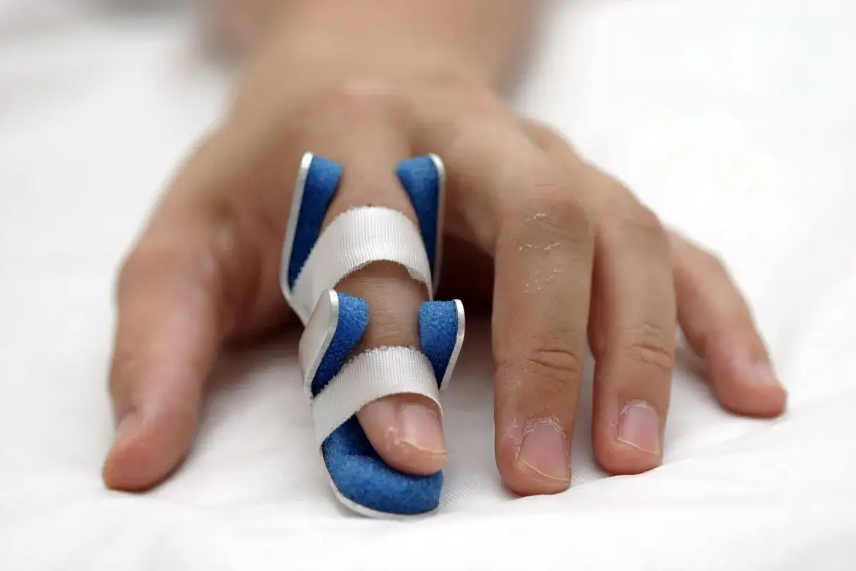 Dłoń z palcem w stabilizatorze, który pomaga w leczeniu palca młoteczkowatego.