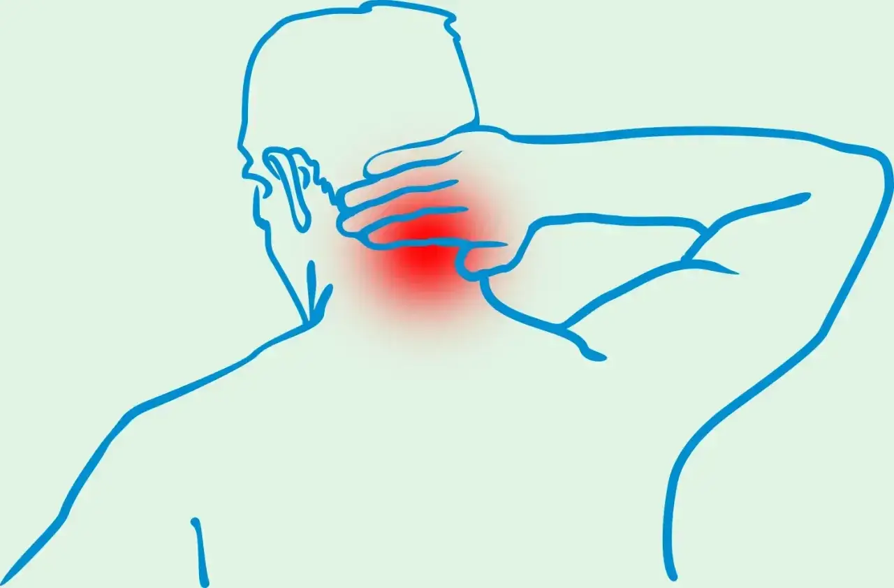 Schmerzende Nackenpartie mit roter Markierung, die auf Osteochondrose hinweist. Wie geht es weiter?