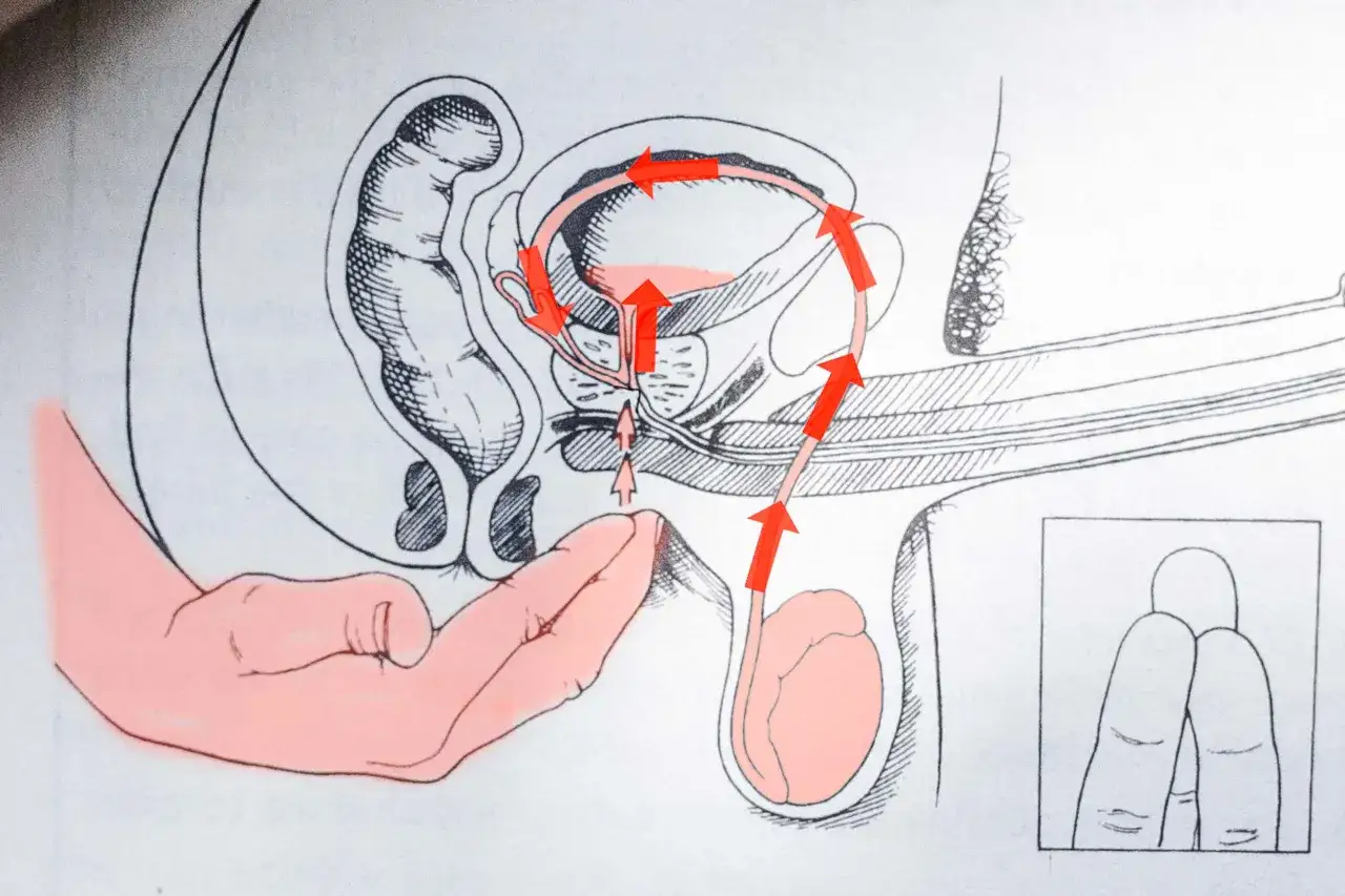 Ilustracja anatomiczna przedstawia drogę nasienia podczas orgazmu. Czerwone strzałki pokazują przepływ, sugerując doświadczenie suchego orgazmu.