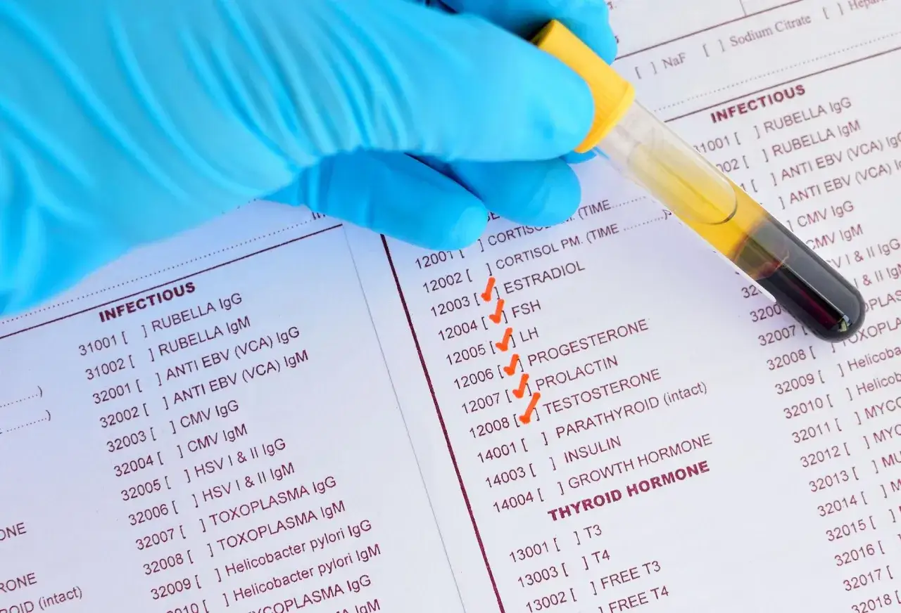Rękawiczka w niebieskiej rękawiczce trzyma probówkę z krwią nad listą badań, gdzie zaznaczono estradiol.