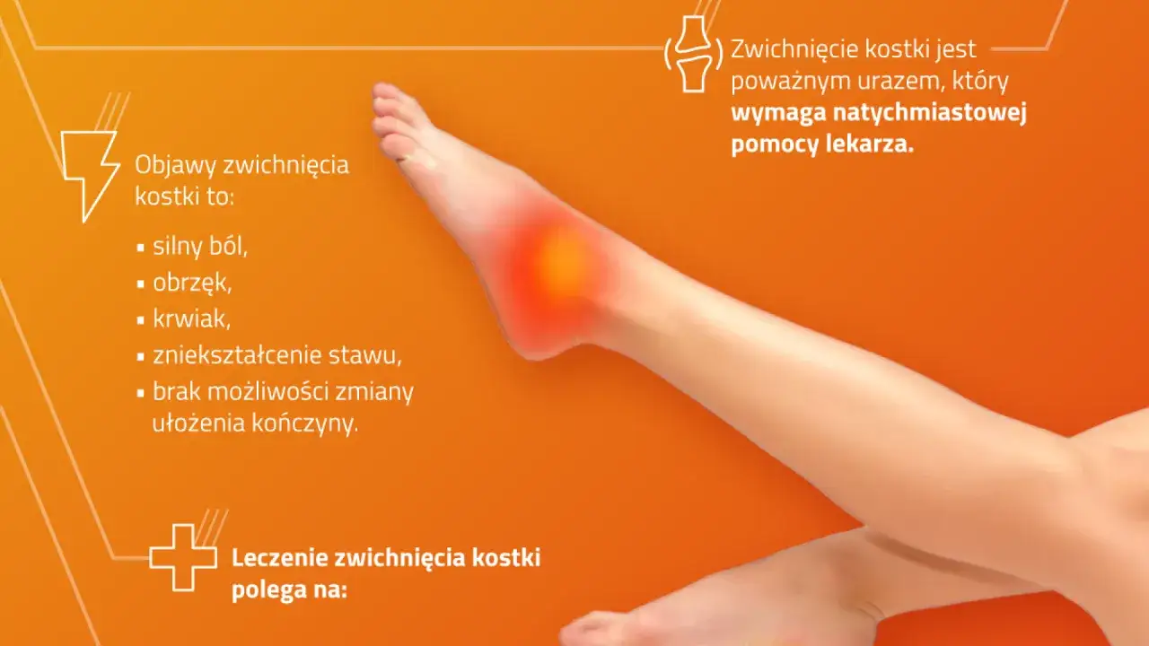objawy poważnego skręcenia kostki kiedy do lekarza