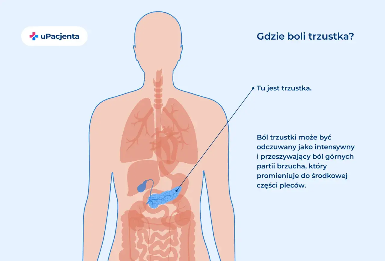 Ilustracja przedstawia lokalizację trzustki w ludzkim ciele. B&oacute;l trzustki może być objawem raka trzustki.