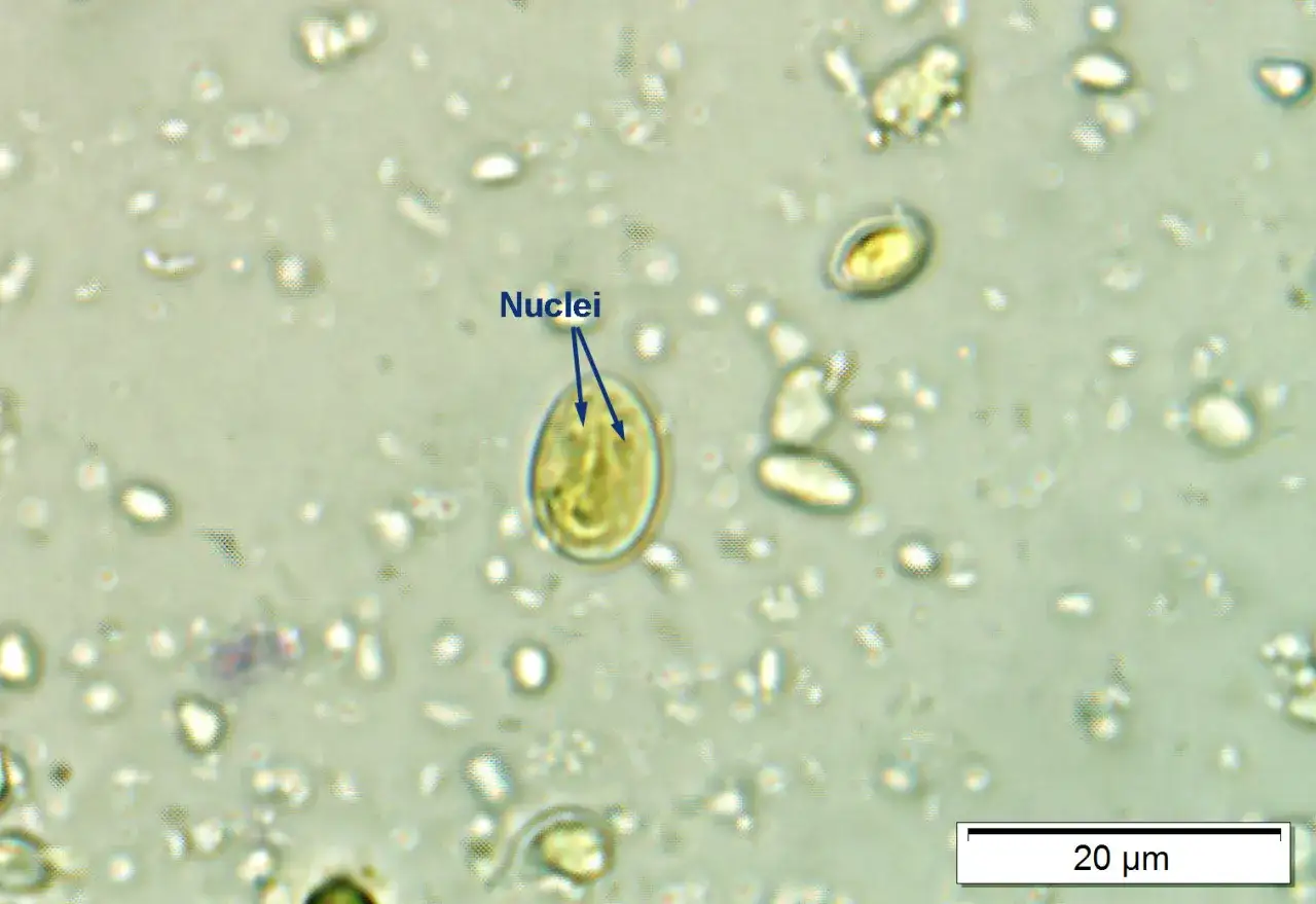 Mikroskopowy obraz cyst Giardia u kota. Widoczne owalne cysty z dwoma jądrami, otoczone innymi drobnoustrojami.