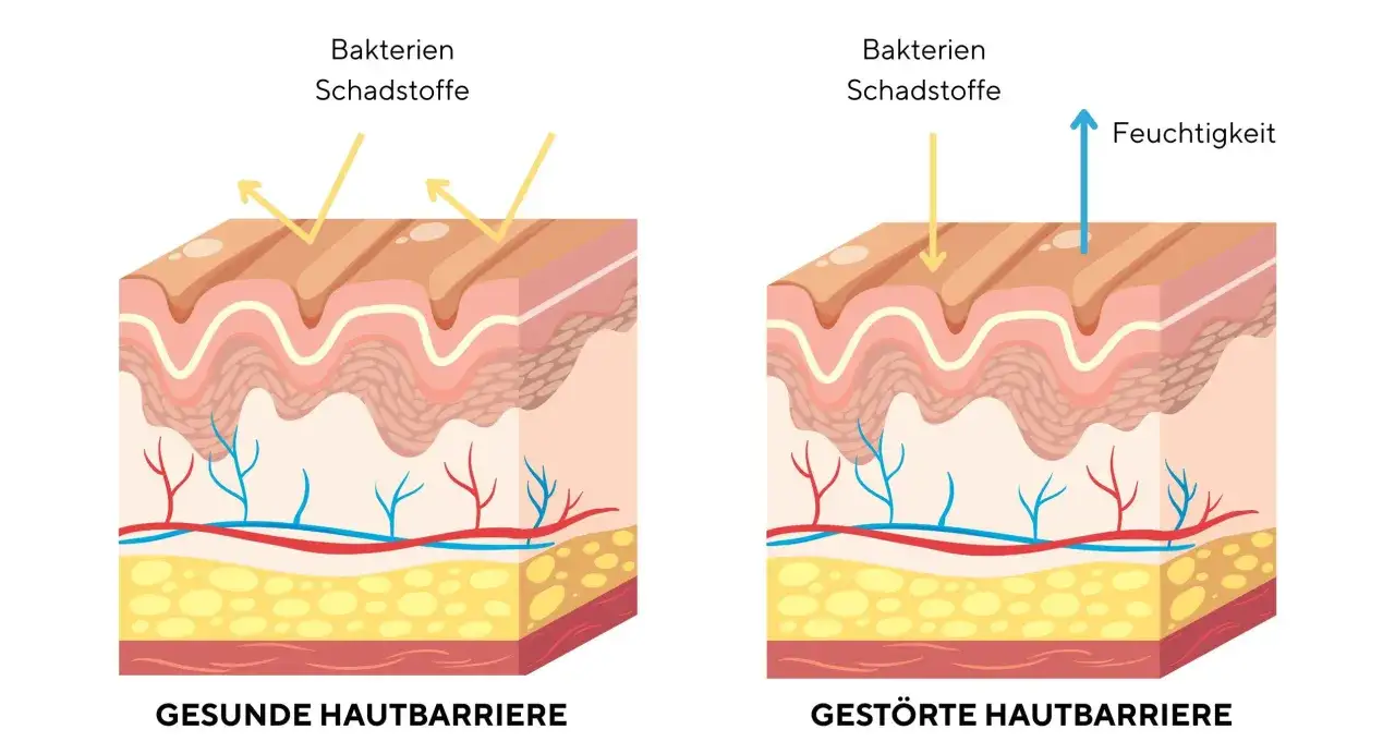 Gesunde Hautbarriere vs. geschädigte Hautbarriere
