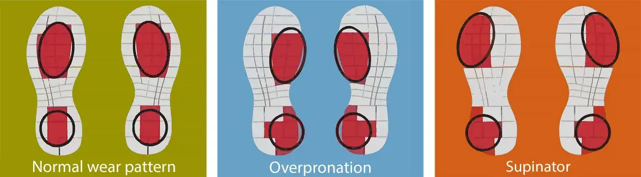Patrones de desgaste de zapatillas: normal, pronador (sobrepronación) y supinador. Muestra cómo el pie impacta y se desgasta el calzado.